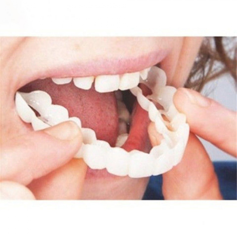 Teeth Whitening For Braces - Mükemmel Fit Yanlış Diş Kapağı Beyazlatma