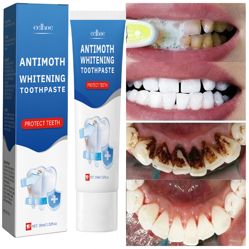 Teeth Whitening Fast - Hızlı Duman Lekelerini Kaldır Diş Macunu