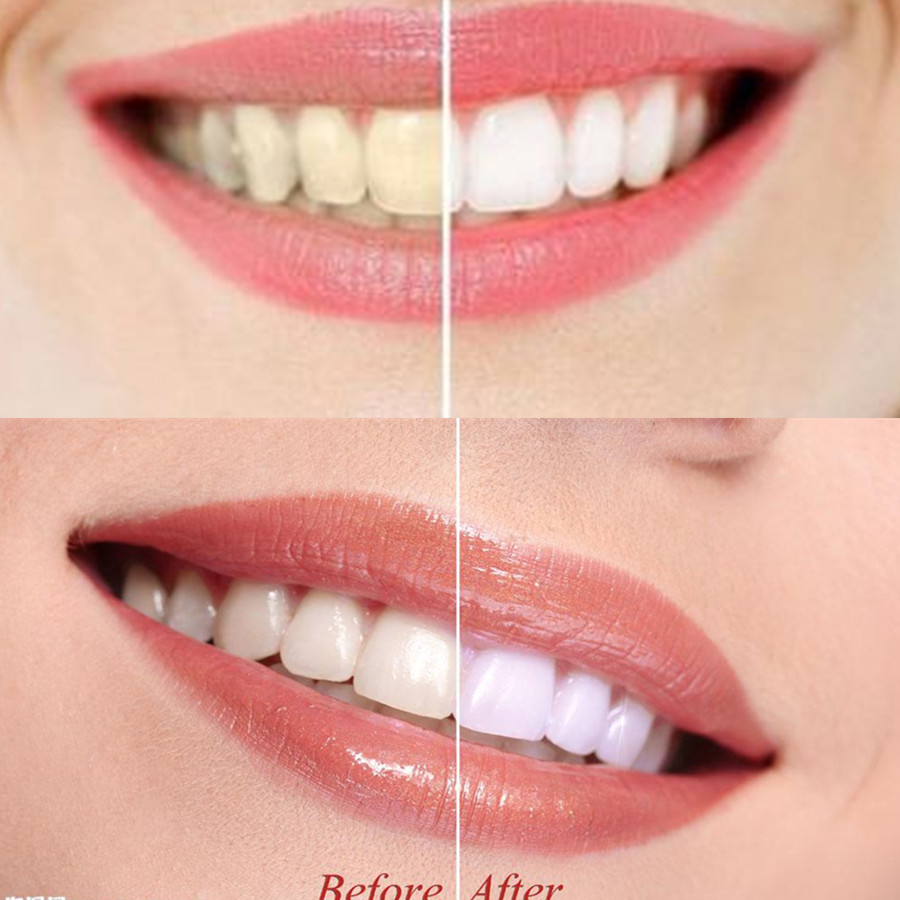 Bambu kömür diş diş diş hekimi - Teeth Whitening Ingredients incelemesi ve fiyatı