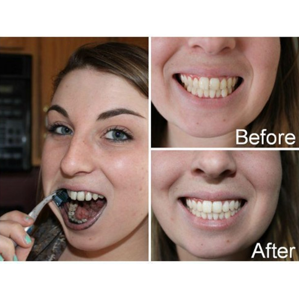 Bambu kömür diş diş diş hekimi - Teeth Whitening Ingredients incelemesi ve fiyatı
