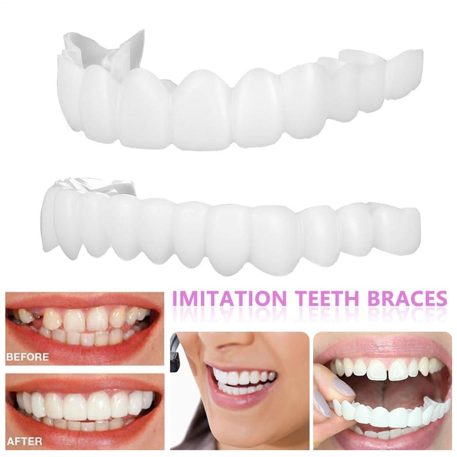 Diş Üst Alt Takma Diş Kaplamas - Teeth Whitening For Braces incelemesi ve fiyatı