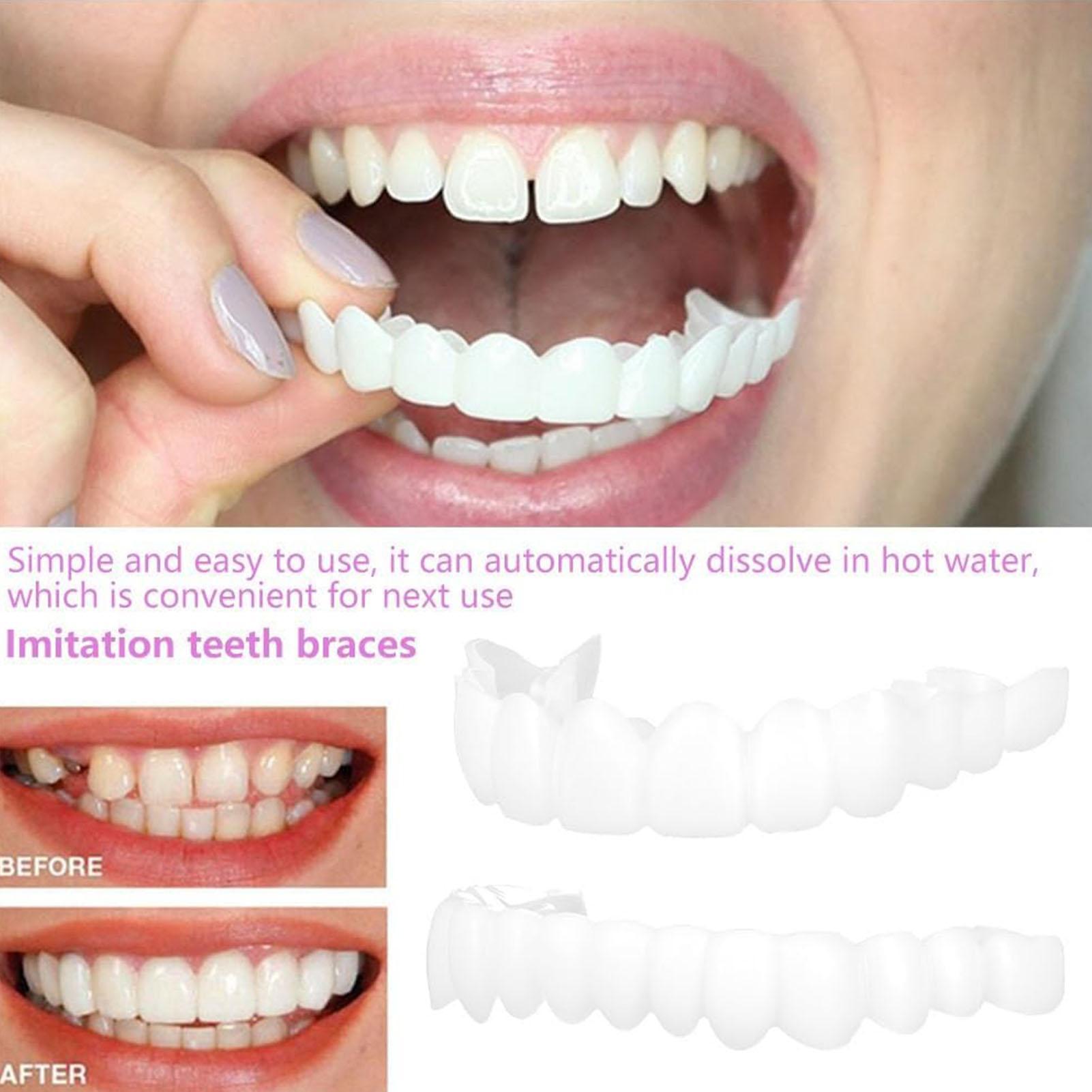 Diş Üst Alt Takma Diş Kaplamas - Teeth Whitening For Braces incelemesi ve fiyatı