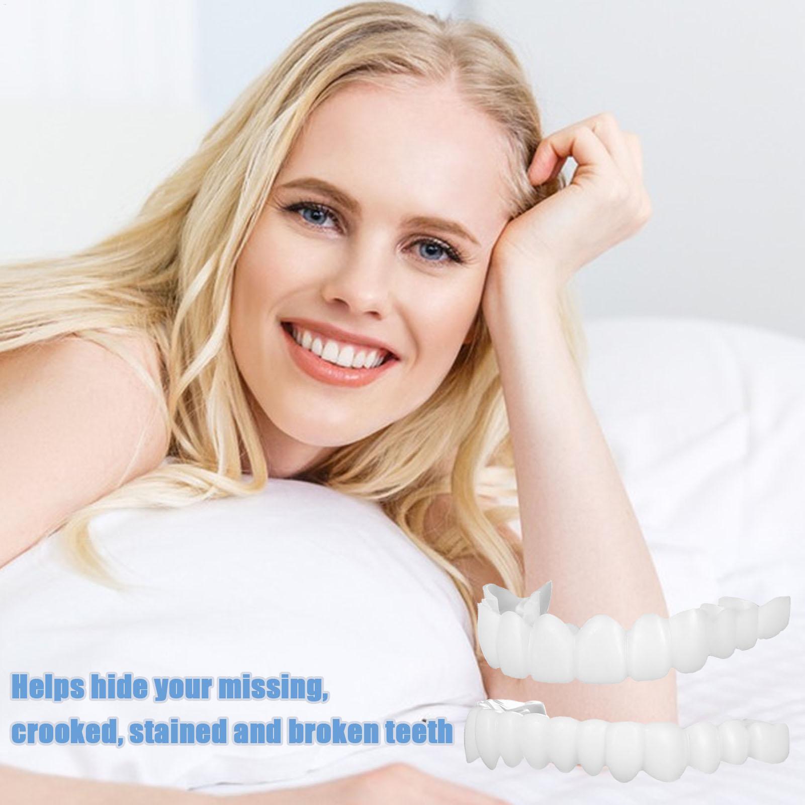 Diş Üst Alt Takma Diş Kaplamas - Teeth Whitening For Braces incelemesi ve fiyatı
