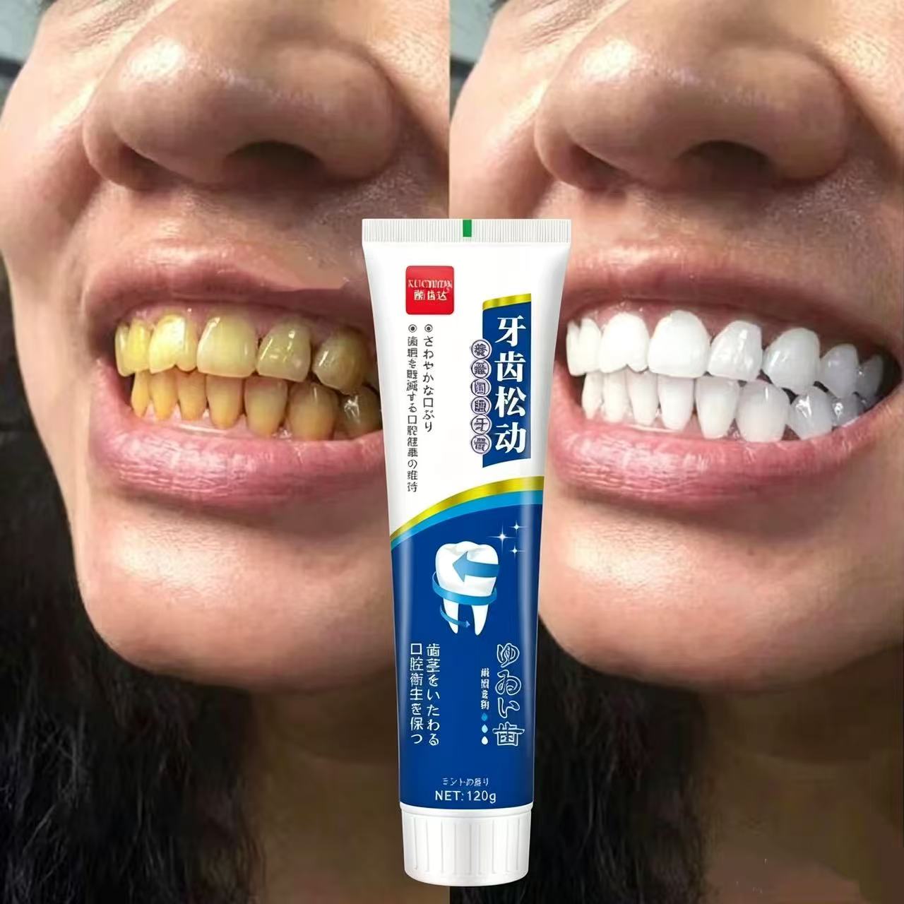 Dökülen dişleri onarıcı Japon  - Teeth Whitening Japan incelemesi ve fiyatı