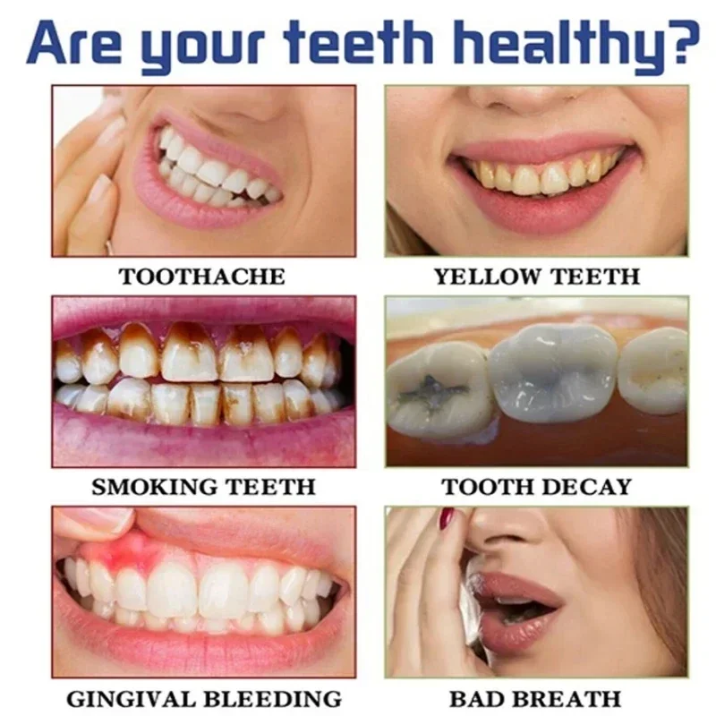 Hızlı Duman Lekelerini Kaldır  - Teeth Whitening Fast incelemesi ve fiyatı
