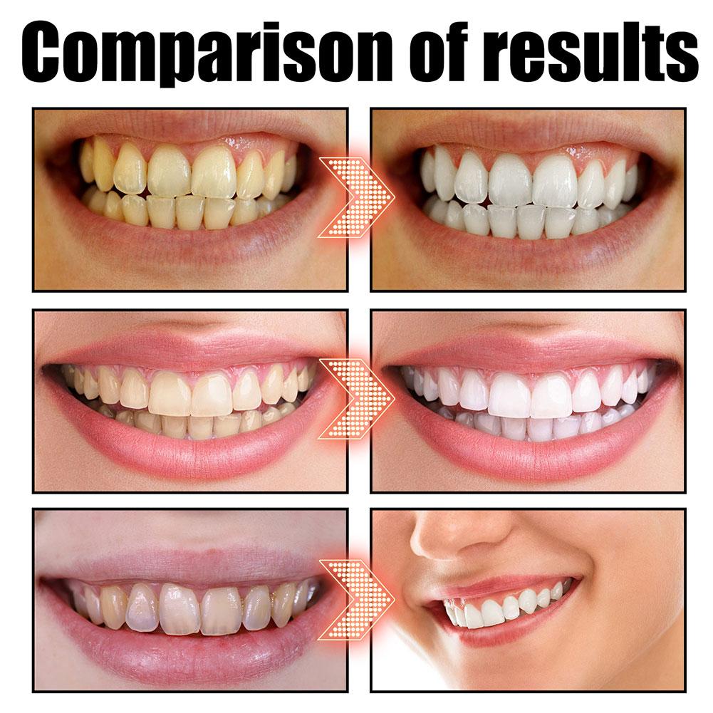 Hindistan Cevizi Naneli Çekird - Teeth Whitening Oil Pulling incelemesi ve fiyatı