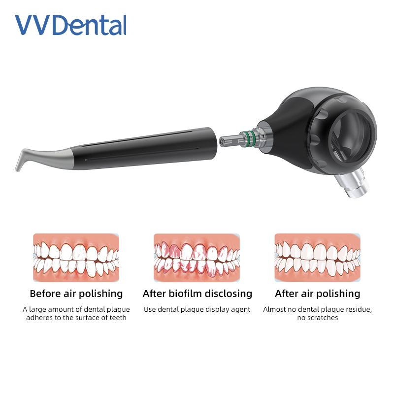 VVDental Hava Parlatıcı Jet Ai - Colgate Whitening Teeth incelemesi ve fiyatı