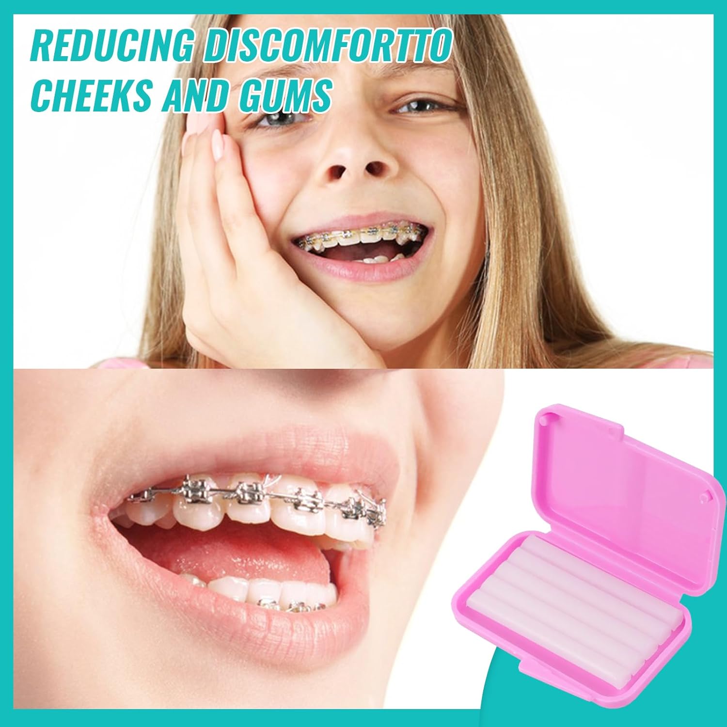 10 kutu diş ortodonti rahatlat - Teeth Whitening For Braces incelemesi ve fiyatı