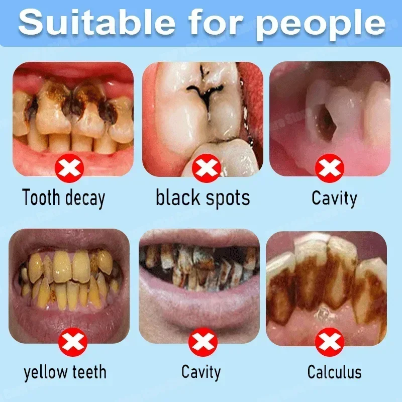 Çürük Önleyici Diş Macunu Çürü - Teeth Whitening Uv incelemesi ve fiyatı