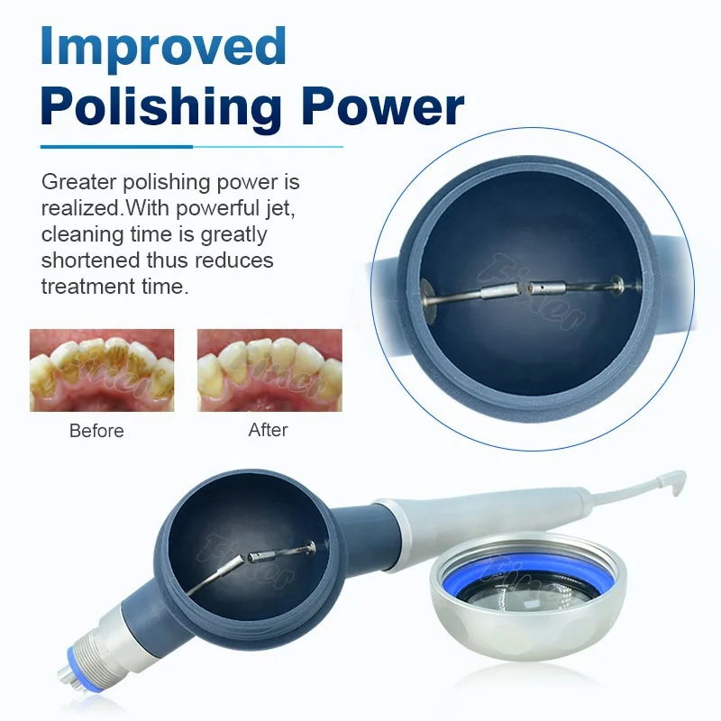 Prophy Mate Diş Temizleme Beya - Teeth Whitening Fast incelemesi ve fiyatı