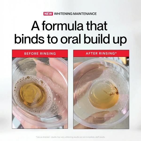 Hismile ID Beyazlatıcı Leke Gi - Teeth Whitening With Peroxide incelemesi ve fiyatı