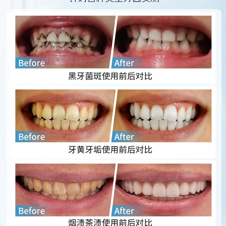 Japonya Manuel Diş Leke Çıkarm - Teeth Whitening Japan incelemesi ve fiyatı