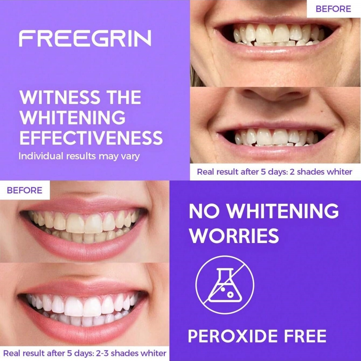 Deluxe Beyazlatma Diş Çıkartma - Teeth Whitening Gel Peroxide incelemesi ve fiyatı