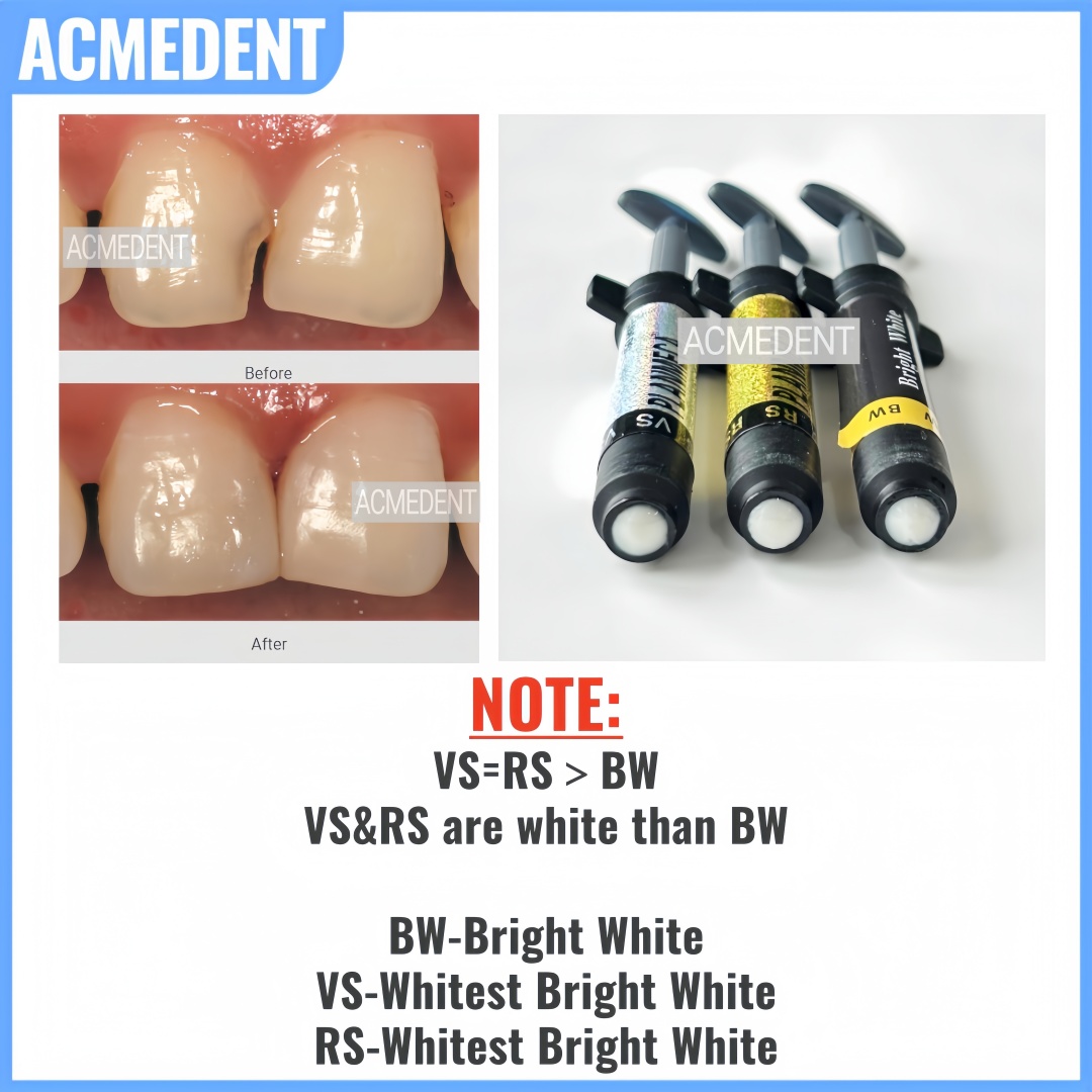 4.5g Diş Kompozit Reçine Kapla - Teeth Whitening Vs Veneers incelemesi ve fiyatı