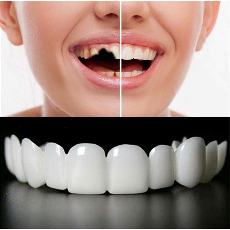 [YENİ!ABMK】 2 Çift, Güzel Gülü - Teeth Whitening For Braces incelemesi ve fiyatı