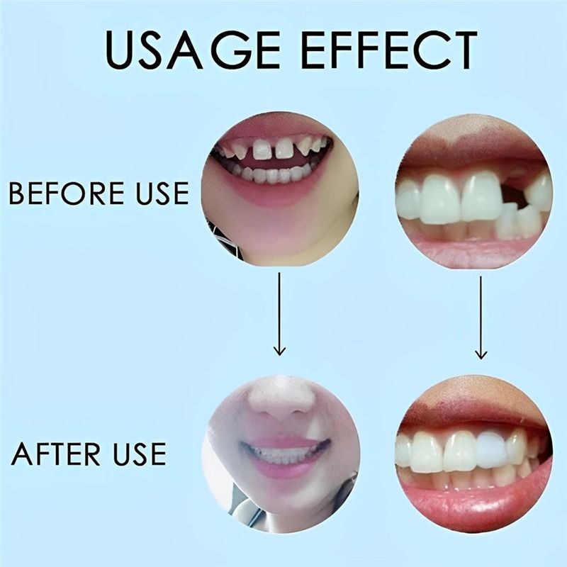 [YENİ!ABMK】 2 Çift, Güzel Gülü - Teeth Whitening For Braces incelemesi ve fiyatı